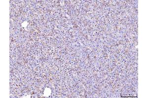 IHC analysis of Poliovirus Receptor/PVR using anti-Poliovirus Receptor/PVR antibody (ABIN7601071).