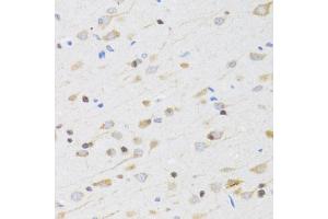 Immunohistochemistry of paraffin-embedded rat brain using CHRM5 antibody (ABIN5973103) at dilution of 1/100 (40x lens).
