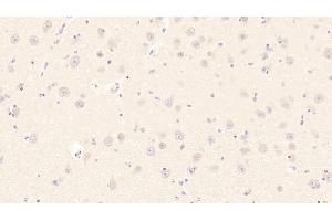Detection of HSPA1B in Bovine Cerebrum Tissue using Monoclonal Antibody to Heat Shock 70 kDa Protein 1B (HSPA1B) (HSPA1B antibody  (AA 1-641))