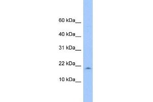 WB Suggested Anti-LOC285033 Antibody Titration: 0. (LOC285033 antibody  (N-Term))
