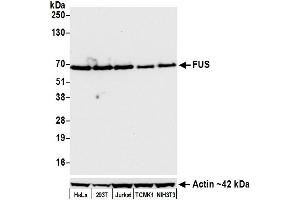 Western Blotting (WB) image for anti-Fused in Sarcoma (FUS) (AA 1-50) antibody (ABIN7454040) (Recombinant FUS antibody  (AA 1-50))