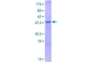 Image no. 1 for Hydroxysteroid (17-Beta) Dehydrogenase 10 (HSD17B10) (AA 1-261) protein (GST tag) (ABIN1307111)