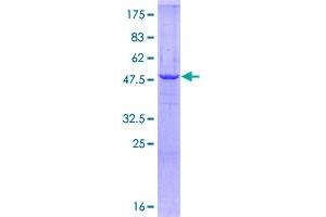 HSD17B10 Protein (AA 1-261) (GST tag)