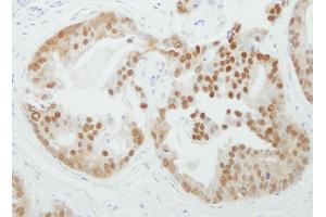 Immunohistochemistry (IHC) image for anti-Protein Arginine Methyltransferase 5 (PRMT5) (C-Term) antibody (ABIN7453831)