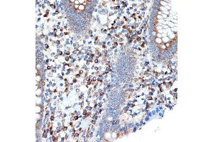 Immunohistochemistry of paraffin-embedded human appendix using LM Rabbit mAb (ABIN7268205) at dilution of 1:100 (40x lens). (LMAN1 antibody)