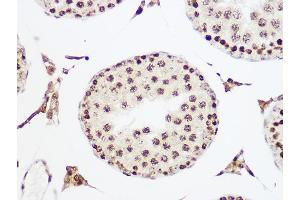 Immunohistochemistry of paraffin-embedded rat testis using MCM5 Rabbit mAb (ABIN7268543) at dilution of 1:100 (40x lens). (MCM5 antibody)