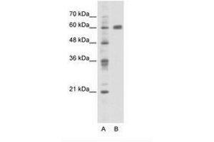 Image no. 1 for anti-PDZ and LIM Domain 5 (PDLIM5) (C-Term) antibody (ABIN202798) (PDLIM5 antibody  (C-Term))