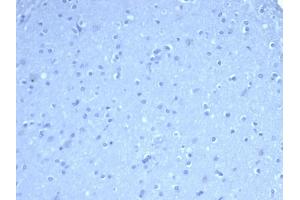 IHC analysis of formalin-fixed, paraffin-embedded human brain. (TOM1L1 antibody)