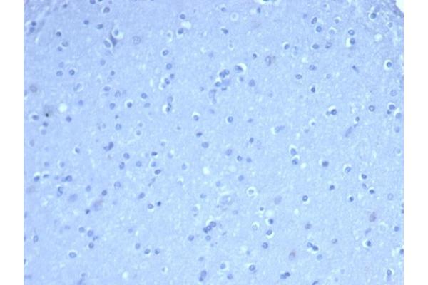 TOM1L1 antibody