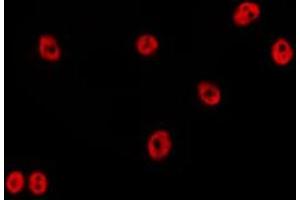 ABIN6278648 staining HepG2 by IF/ICC. (ZNF23 antibody)