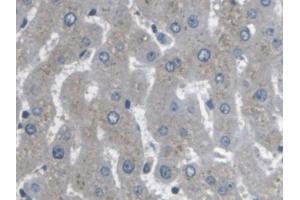 IHC-P analysis of Human Liver Tissue, with DAB staining. (ARPC4 antibody  (AA 3-165))