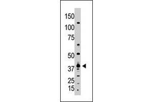 The GDF1 polyclonal antibody  is used in Western blot to detect GDF1 in A-375 cell lysate.
