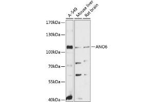 Western blot analysis of extracts of various cell lines, using  antibody (ABIN6129707, ABIN6136907, ABIN6136908 and ABIN6215620) at 1:3000 dilution. (Anoctamin 6 antibody  (AA 750-830))