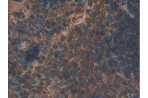 Immunohistochemistry (IHC) image for anti-Interleukin 22 Receptor, alpha 2 (IL22RA2) (AA 30-228) antibody (ABIN7435865)