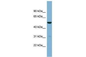 SDSL antibody used at 1 ug/ml to detect target protein. (SDSL antibody  (Middle Region))