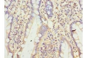 Immunohistochemistry of paraffin-embedded human small intestine tissue using ABIN7165217 at dilution of 1:100
