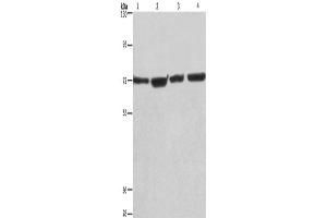 Western Blotting (WB) image for anti-Kruppel-Like Factor 11 (KLF11) antibody (ABIN2428323)