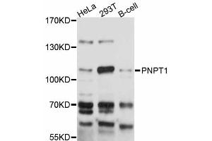 Western blot analysis of extracts of various cell lines, using PNPT1 antibody (ABIN5998548) at 1:3000 dilution. (PNPT1 antibody)