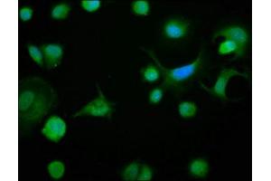 Immunofluorescence staining of MCF-7 cells with ABIN7145294 at 1:133, counter-stained with DAPI. (BCL2L1 antibody  (AA 1-209))