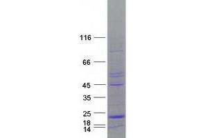 Validation with Western Blot (Mtfp1 Protein (Transcript Variant 1) (Myc-DYKDDDDK Tag))