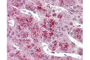 Anti-GLP2R antibody IHC of human adrenal. (GLP2R antibody  (C-Term))