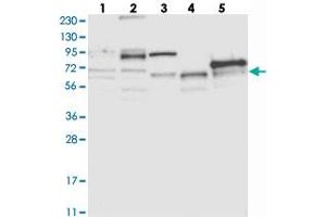 Western blot analysis of Lane 1: RT-4, Lane 2: U-251 MG, Lane 3: Human Plasma, Lane 4: Liver, Lane 5: Tonsil with ABLIM2 polyclonal antibody . (ABLIM2 antibody)