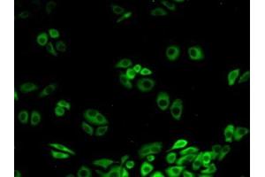 Detection of CACYBP in Human Hela Cells using Polyclonal Antibody to Calcyclin Binding Protein (CACYBP) (CACYBP antibody  (AA 2-228))