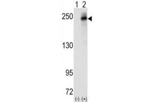 Western blot analysis of ALK antibody and 293 cell lysate (2 ug/lane) either nontransfected (Lane 1) or transiently transfected with the human gene (2).