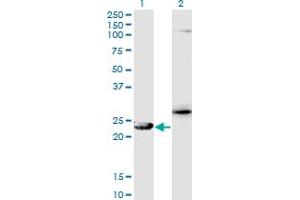 Western Blot analysis of GSTZ1 expression in transfected 293T cell line by GSTZ1 monoclonal antibody (M01), clone 1G12.