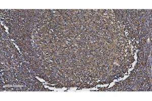 IHC analysis of MEF2C using anti-MEF2C antibody (ABIN6719606). (MEF2C antibody)