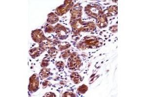 Immunohistochemistry analysis in formalin fixed and paraffin embedded human breast tissue reacted with IMPDH1 / IMPD1 Antibody (N-term) followed by peroxidase conjugation of the secondary antibody and DAB staining. (IMPDH1 antibody  (N-Term))