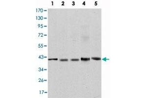 Western blot analysis using REL monoclonal antibody, clone 1E7  against Jurkat (1), NIH/3T3 (2), HeLa (3), HEK293 (4) and Raji (5) cell lysate.