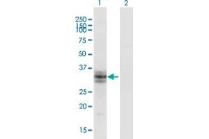 Western Blot analysis of B3GALT6 expression in transfected 293T cell line by B3GALT6 monoclonal antibody (M06), clone 3E5. (B3GALT6 antibody  (AA 229-329))