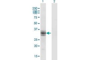 Western Blot analysis of B3GALT6 expression in transfected 293T cell line by B3GALT6 monoclonal antibody (M06), clone 3E5.