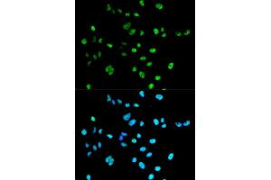 Immunofluorescence analysis of A549 cells using PAX2 antibody (ABIN5971568).