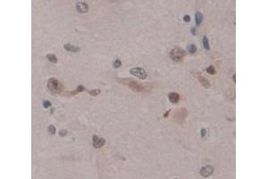 Figure. (E2F2 antibody  (AA 129-429))