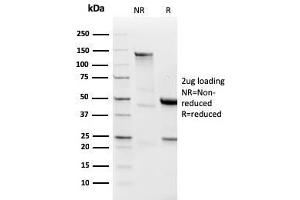 SDS-PAGE Analysis Purified Lambda Light Chain Recombinant Rabbit Monoclonal (LLC/3778R). (Recombinant IgL antibody)