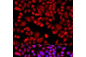 Immunofluorescence analysis of A549 cells using ARPC3 Polyclonal Antibody (ARPC3 antibody)
