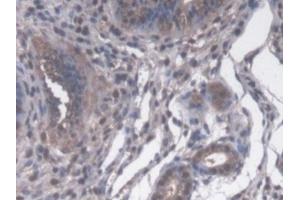 Detection of CYP-40 in Mouse Uterus Tissue using Polyclonal Antibody to Cyclophilin 40 (CYP-40) (PPID antibody  (AA 9-189))