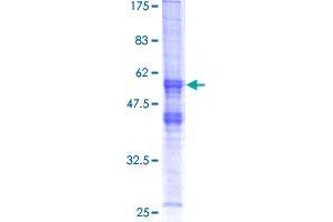XRCC2 Protein (AA 1-280) (GST tag)