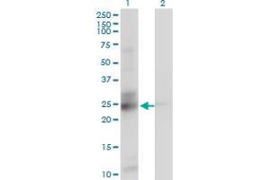 Western Blotting (WB) image for anti-Chromosome 21 Open Reading Frame 33 (C21orf33) (AA 188-269) antibody (ABIN599034) (C21orf33 antibody  (AA 188-269))