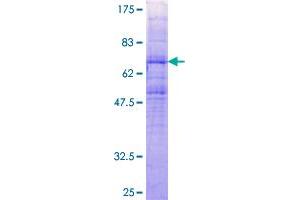 CCBP2 Protein (AA 1-384) (GST tag)
