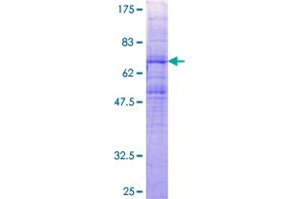 CCBP2 Protein (AA 1-384) (GST tag)