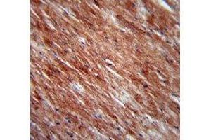 IL-2 antibody immunohistochemistry analysis in formalin fixed and paraffin embedded mouse heart tissue. (IL-2 antibody  (AA 50-77))