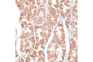 Immunohistochemistry of paraffin-embedded human stomach using KIF4A antibody (ABIN6128156, ABIN6142873, ABIN6142874 and ABIN6214349) at dilution of 1:100 (40x lens). (KIF4A antibody  (AA 870-1080))