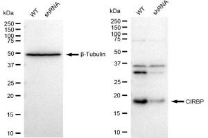 Western blotting analysis using CIRBP antibody (ABIN7798120).