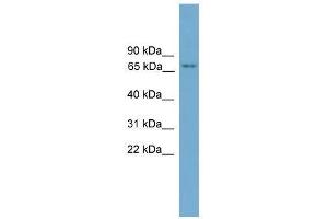 Western Blot showing PRKCH antibody used at a concentration of 1. (PKC eta antibody  (N-Term))