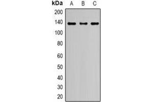 Western blot analysis of Nephrin expression in HeLa (A), HEK293T (B), PC12 (C) whole cell lysates.