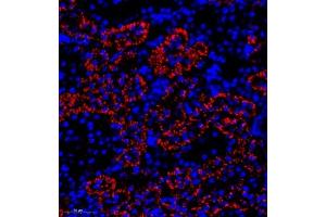 Immunofluorescence of paraffin embedded rat kidney using SLC22A12 (ABIN7075662) at dilution of 1:2000 (300x lens) (SLC22A12 antibody)