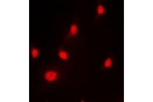 Immunofluorescent analysis of hnRNP L staining in HeLa cells.